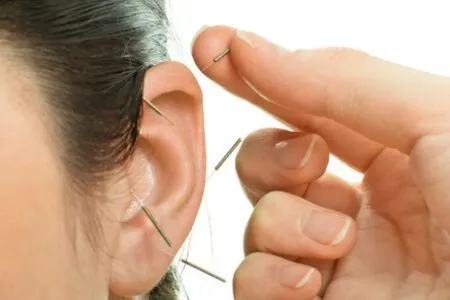 Auricular Therapy