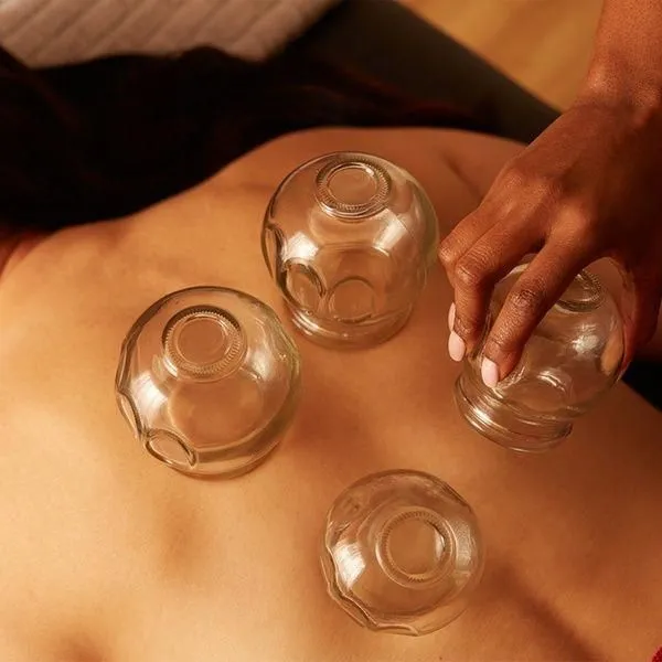 Cupping Therapy